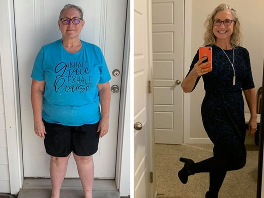 12 Inspiring Weight Loss Transformation Photos