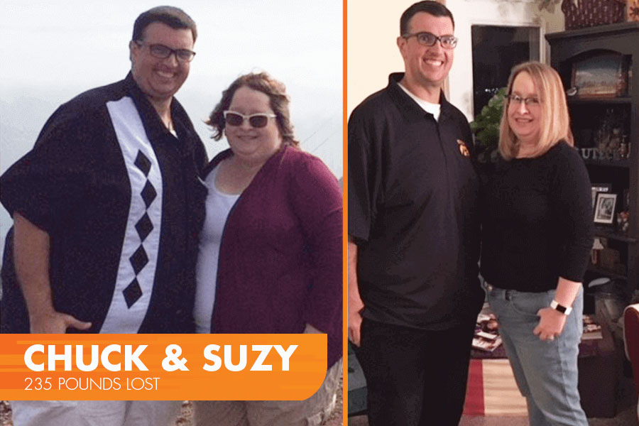 Chuck and Suzy's Profile by Sanford Weight Loss Journey. Side-by-side before and after photos.